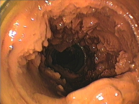 築３０年のマンション水道管内の様子